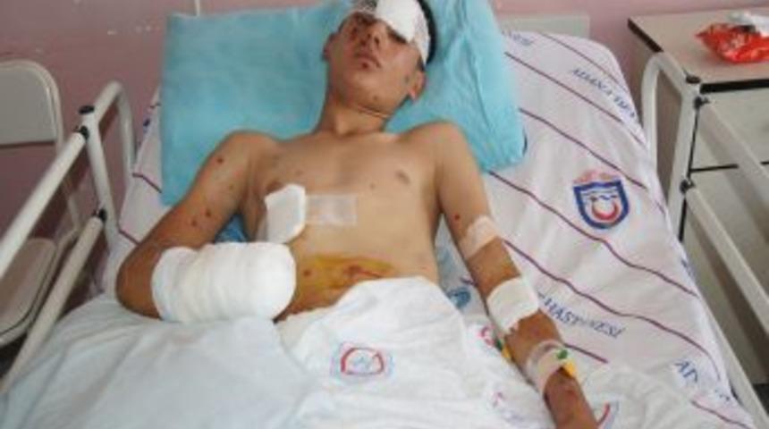 Polise atacağı bomba patlayınca sağ eli koptu