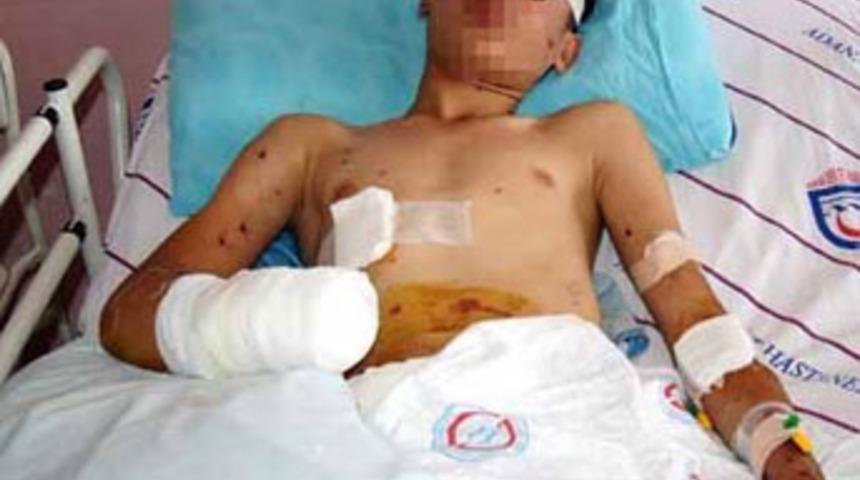 Polis atmak istediği bomba kolunu kopardı