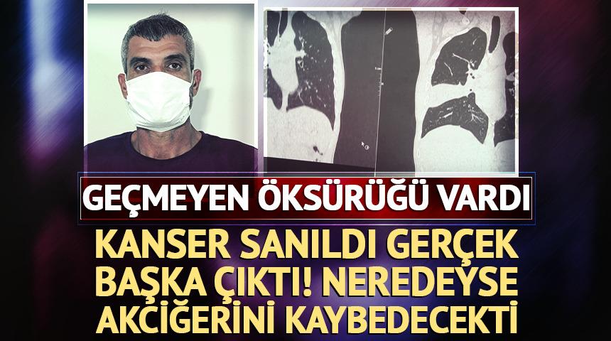 İnat&ccedil;ı &ouml;ks&uuml;r&uuml;ğ&uuml; vardı: Kanser sanıldı ger&ccedil;ek başka &ccedil;ıktı