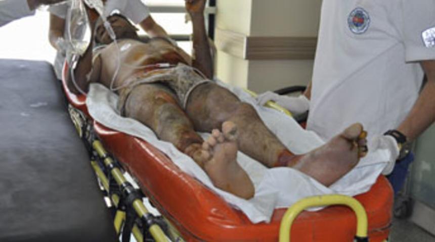 B&ouml;yle talihsiz iş&ccedil;i g&ouml;r&uuml;lmedi