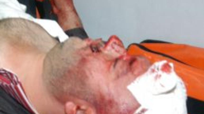 K&uuml;tahya'da silahlı kavga: 2 ağır yaralı