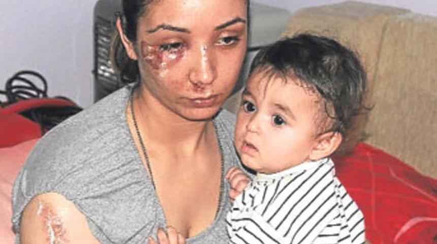 Koca dayağı bu hale getirdi