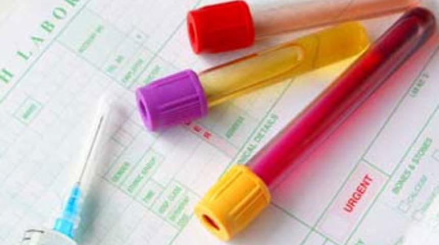 Bir bu &ccedil;alınmamıştı!