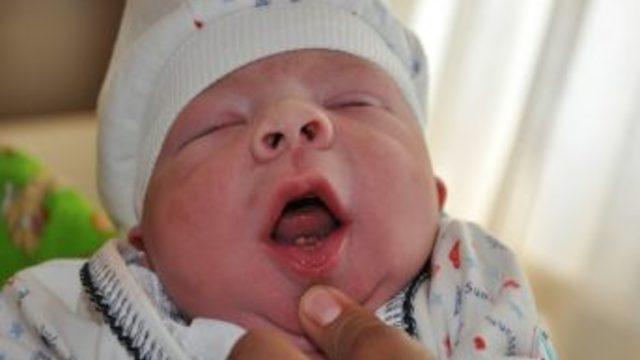 2 dişi ile doğan Mehmet bebek hayrete düşürdü