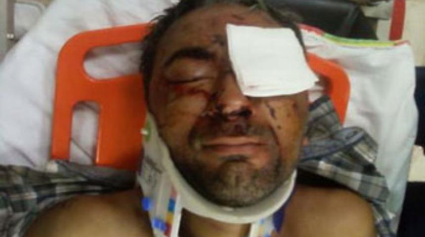 Karakolda dayak iddiası