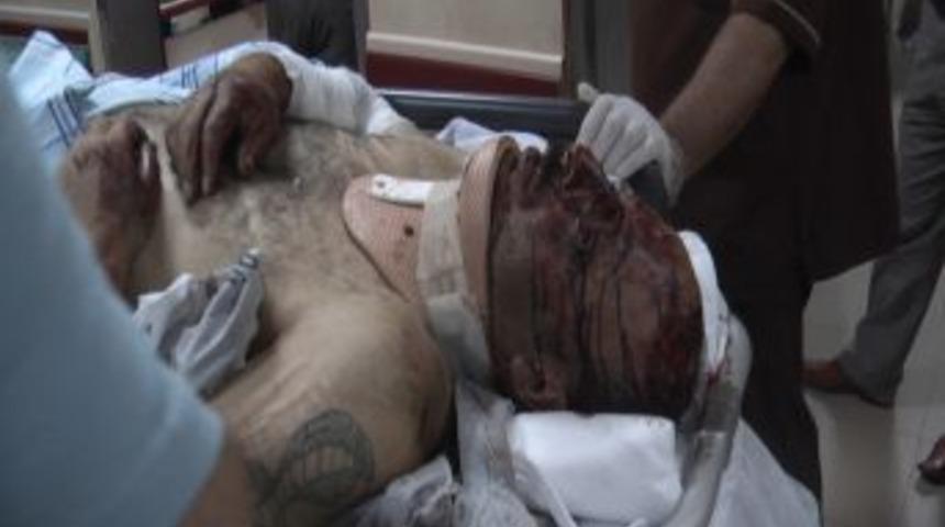 Beton mikseri petrol istasyonuna &ccedil;arptı: 4'&uuml; ağır 5 yaralı