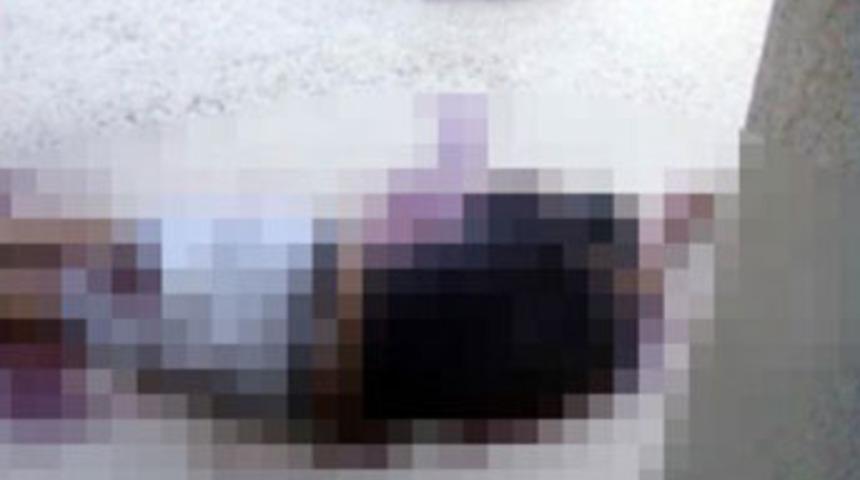 Bomba elinde patladı