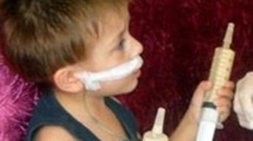 Boğazındaki pille 15 g&uuml;n yaşadı