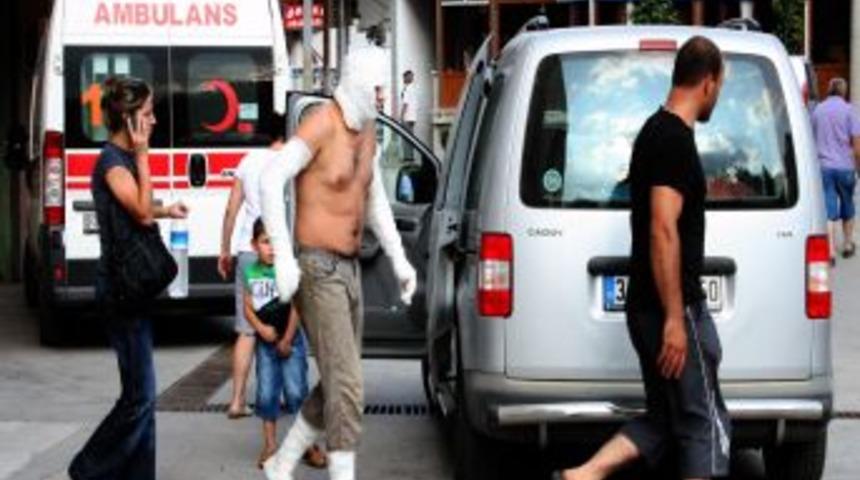 Fabrika mutfağında patlama: 1 yaralı