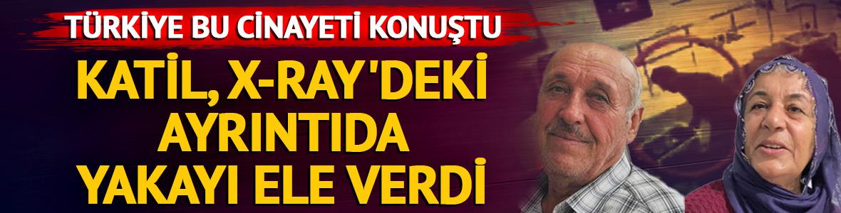 &Ccedil;ifte cinayete yangın s&uuml;s&uuml; vermeye &ccedil;alışmıştı! Katil, X-Ray'deki ayrıntıyla yakalandı