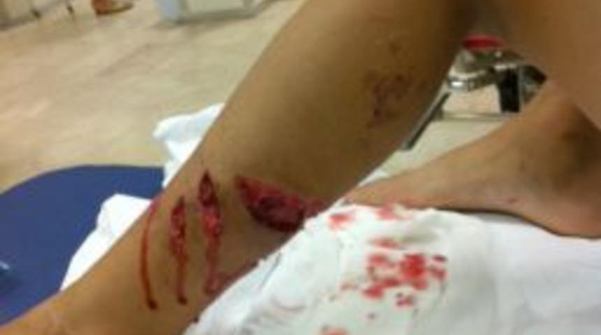 Kangal k&ouml;peği &ccedil;ocuğa saldırdı