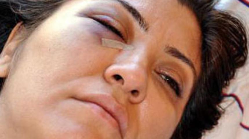 Acil serviste kadın doktora dayak