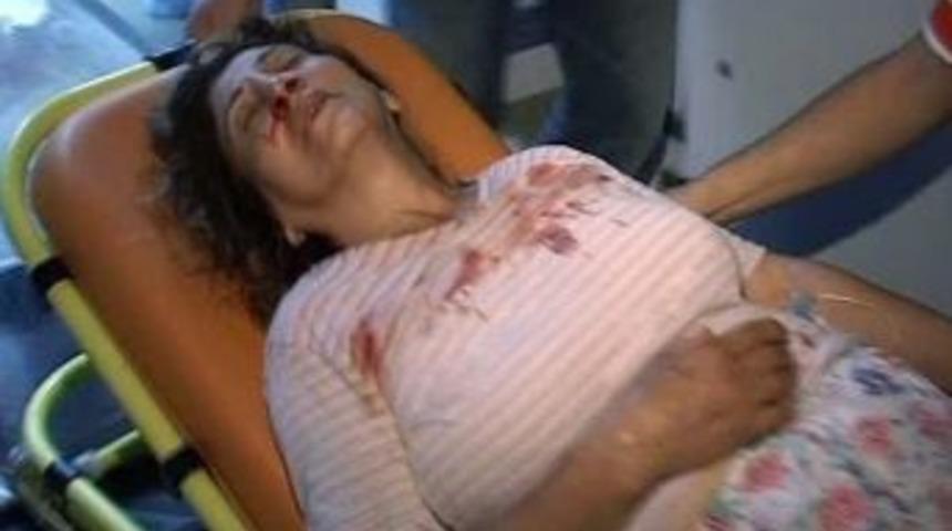 Koca şiddeti bayram g&uuml;n&uuml; hastanelik etti