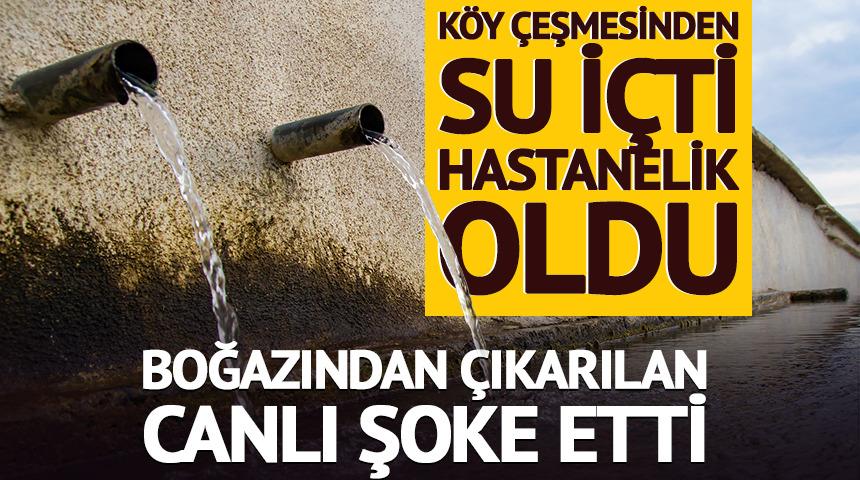 K&ouml;y &ccedil;eşmesinden su i&ccedil;ti hastanelik oldu! Boğazından &ccedil;ıkarılan canlı şoke etti