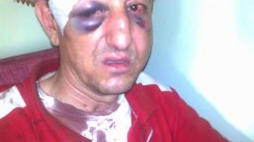 Polis memuru, &lsquo;korna &ccedil;alma&rsquo; diye uyaran pompacıyı darp etti