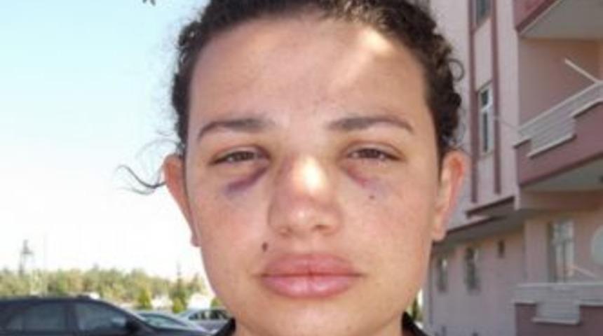 Hastanede doktor d&ouml;v&uuml;l&uuml;r, a&ccedil;ıklama yapılamaz!