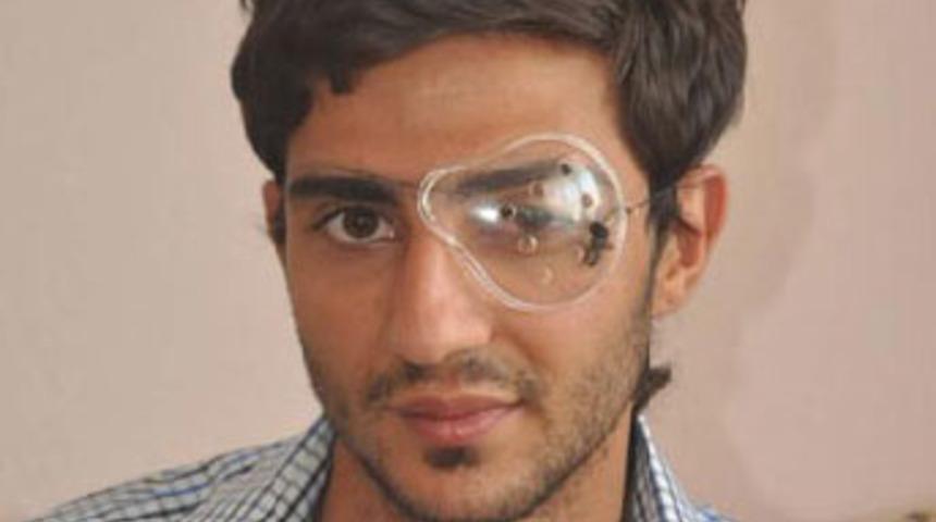 Paintball topu k&ouml;r etti