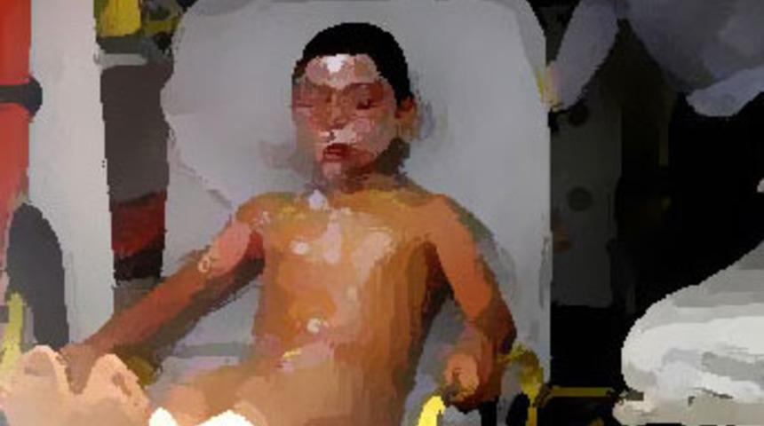 D&uuml;d&uuml;kl&uuml; tencere patladı; 2 yaralı