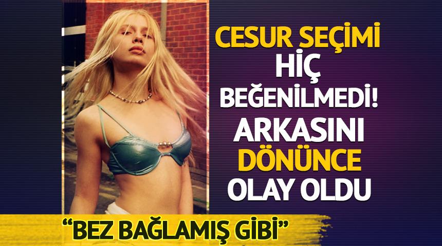 Arkasını d&ouml;n&uuml;nce olay oldu: 'Bez bağlamış gibi'