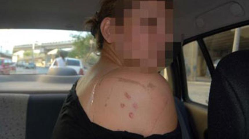 Başında şişe kırıp, &uuml;st&uuml;nde sigara s&ouml;nd&uuml;rd&uuml;