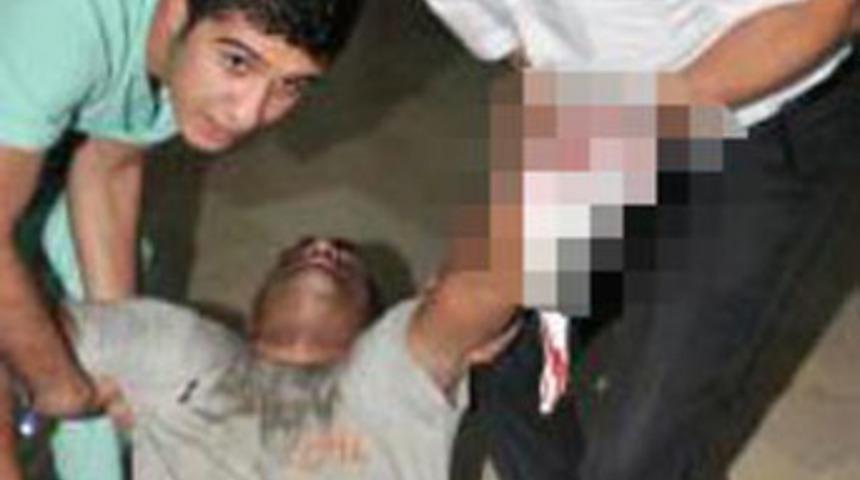 Kopan parmaklarıyla 3 hastane gezdi