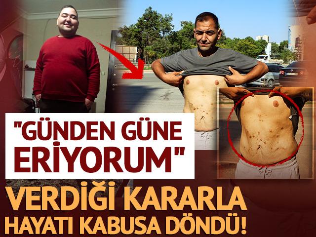 Zayıflamak i&ccedil;in ameliyat oldu: Hayatı kabusa d&ouml;nd&uuml;!