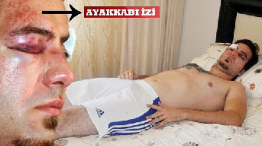 Alanya'da bodyguard dehşeti