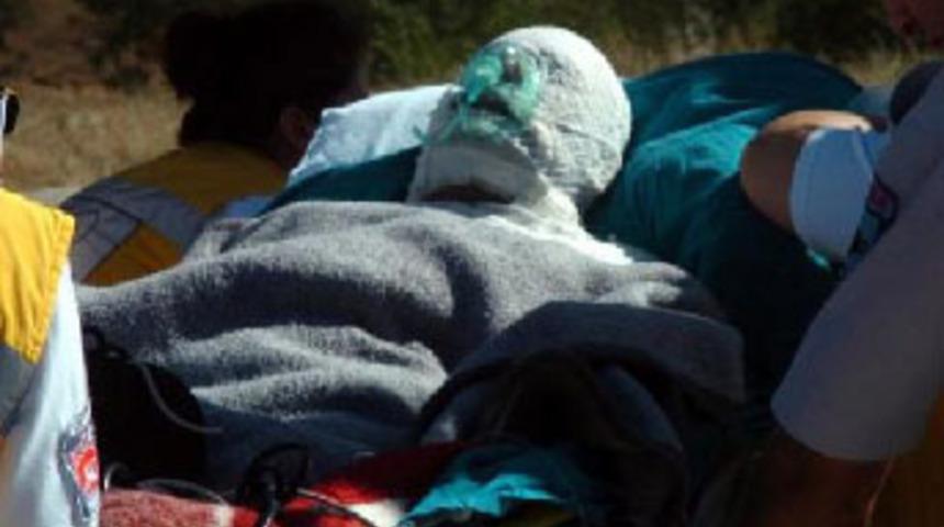 Eski kocasının y&uuml;z&uuml;ne benzin d&ouml;k&uuml;p yaktı