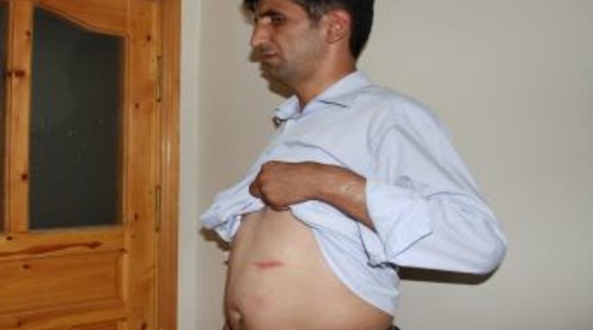 Ağrı'da gazeteciye koruma dayağı iddiası