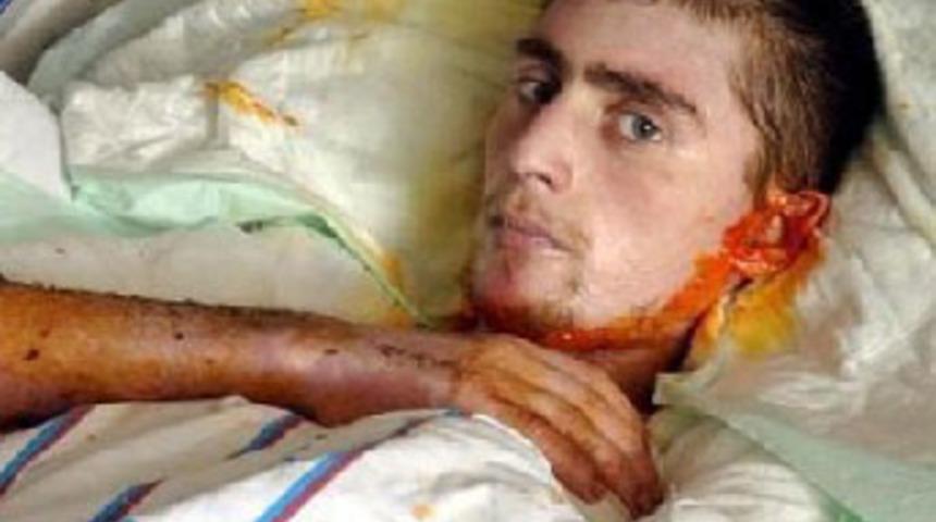 Arkadaşını yakarak &ouml;ld&uuml;ren gen&ccedil; tahliye oldu