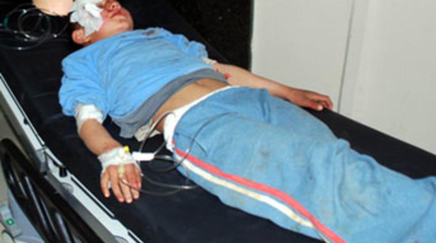 Oyun oynayan &ccedil;ocuklara otomobil &ccedil;arptı