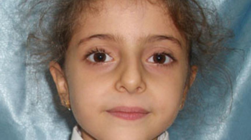 Bisikletten d&uuml;şen Rahime kurtarılamadı