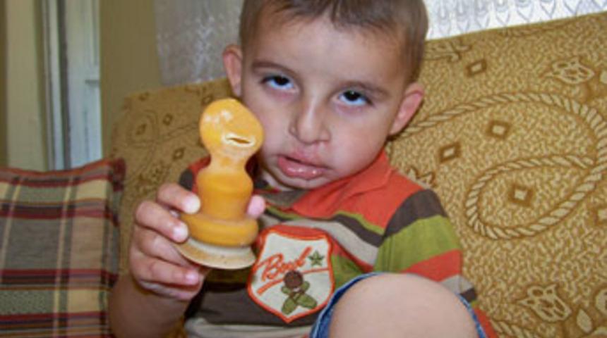 3 yaşındaki Adem'in dramı