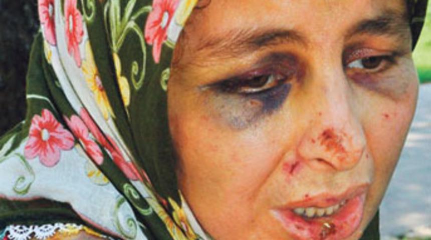 Kerpetenle işkence, ikinci kattan atlattı