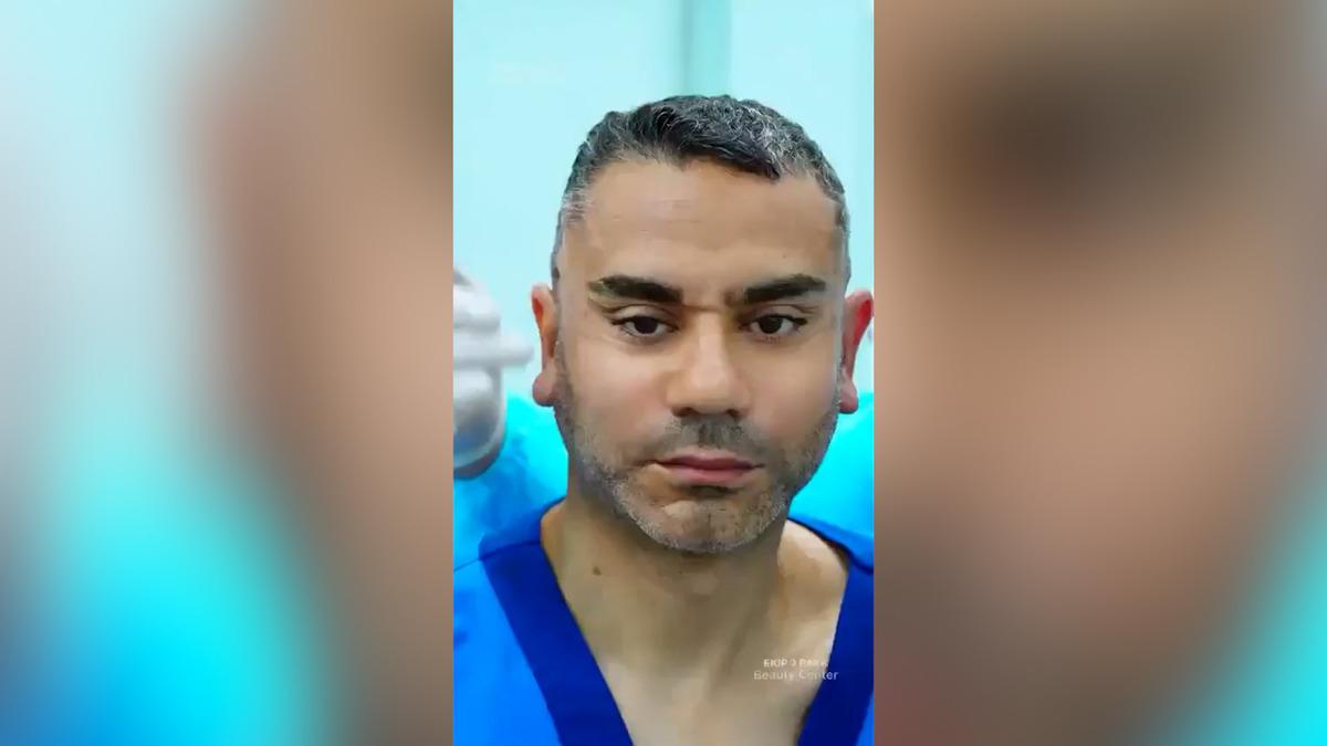 58 yaşında gençleşmek için Vietnam a gitti! "20 yaş gençleşti" iddiası sosyal medyayı karıştırdı 2