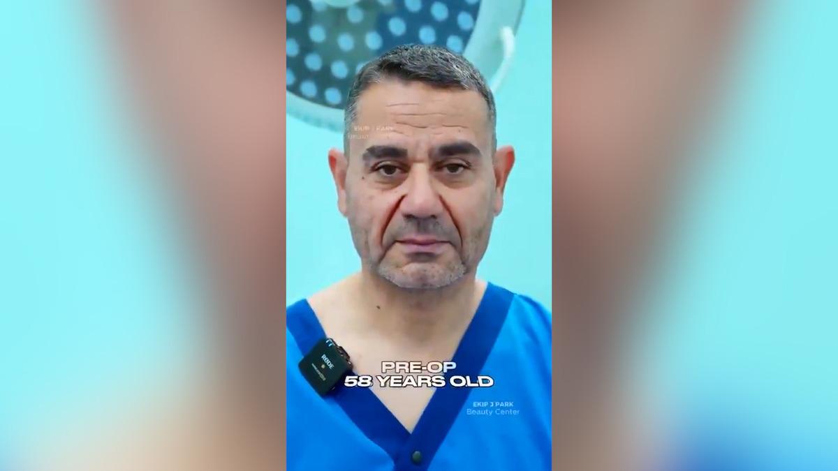 58 yaşında gençleşmek için Vietnam a gitti! "20 yaş gençleşti" iddiası sosyal medyayı karıştırdı 3