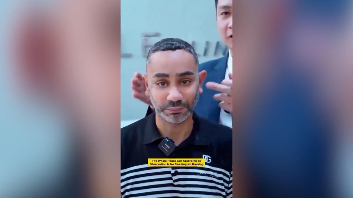 58 yaşında gençleşmek için Vietnam a gitti! "20 yaş gençleşti" iddiası sosyal medyayı karıştırdı 5
