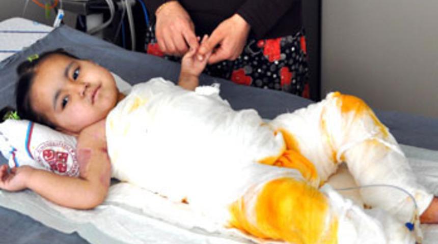 Kendini yakan Merve hayata tutunamadı