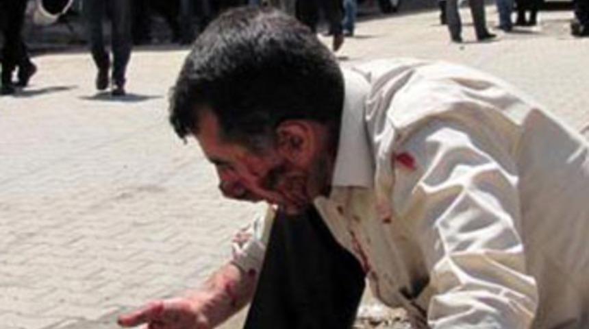 Ter&ouml;rist cenazesinde olaylar &ccedil;ıktı