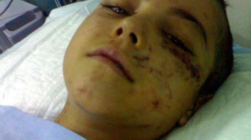 K&ouml;peklerin saldırısına uğradı