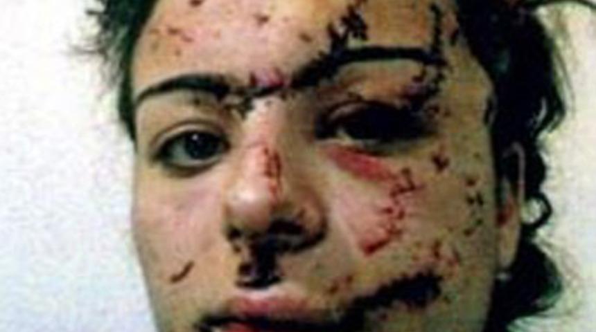 Zorla değil, Yargıtay kararıyla "g&uuml;zellik"