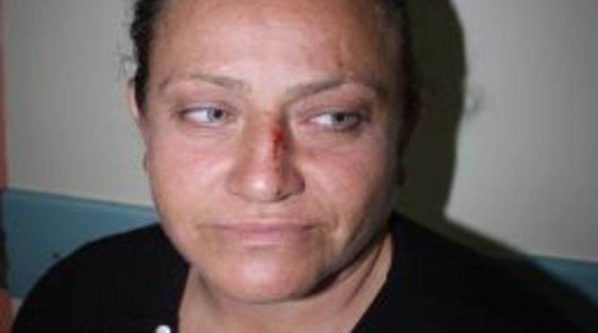 Kapka&ccedil;&ccedil;ıların s&uuml;r&uuml;klediği iki kadın yaralandı