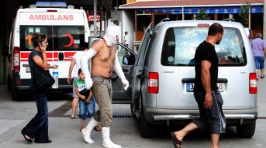 Mutfak gazı alev aldı 1 kişi yaralandı