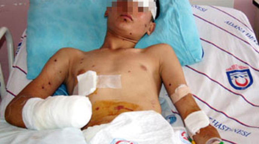 Elinde bomba patlayan &ccedil;ocuğa dava