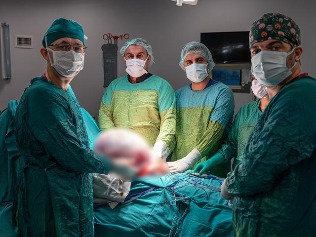 Sadece şişkinlik sanıyordu: Ger&ccedil;ek ameliyatta ortaya &ccedil;ıktı