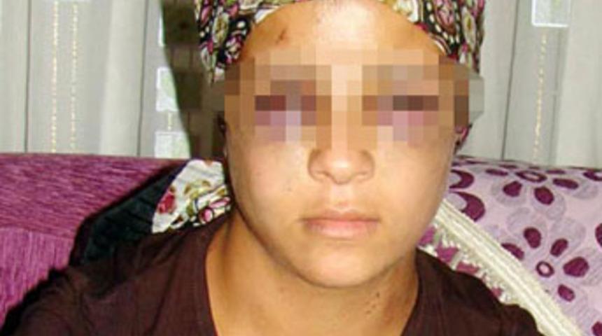 Gen&ccedil; kadına işkence iddiası