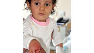 Elini keçi ısırdı