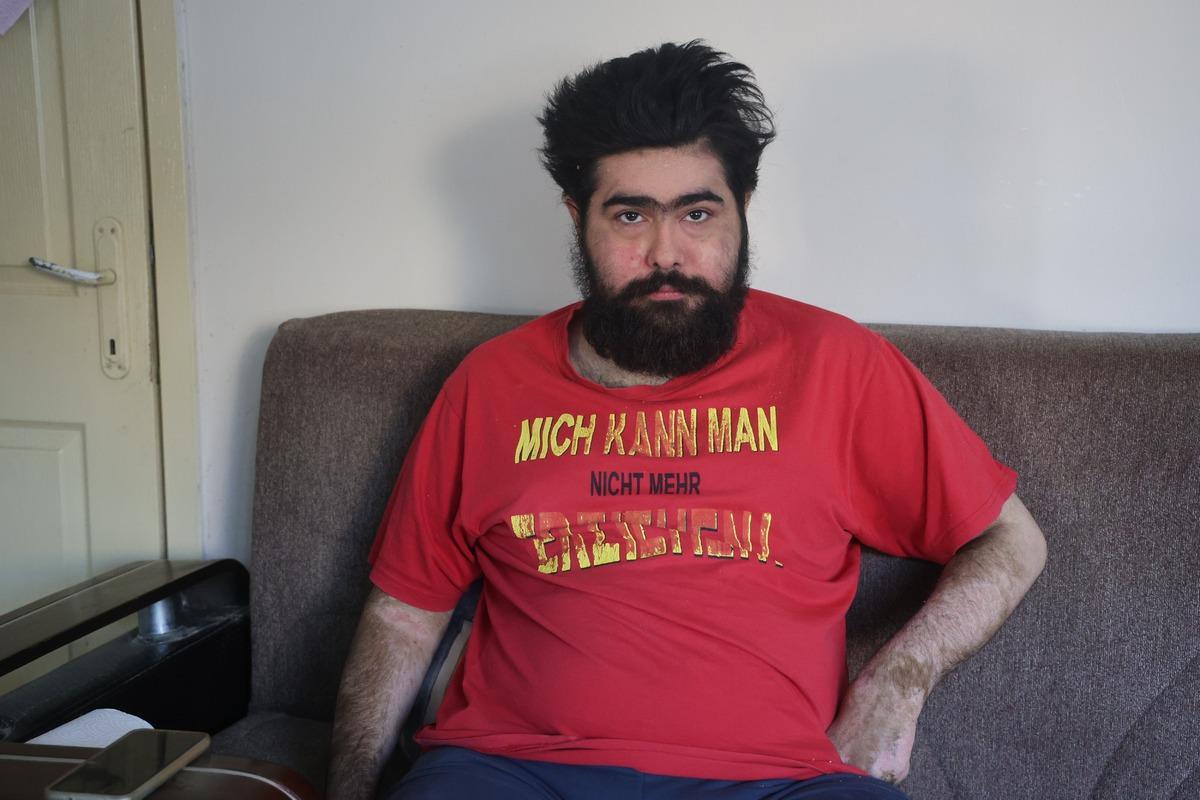 3 yıl sonra duş alıp, tıraş olan Barış tedaviyi reddetti: Son hali ortaya çıktı 1