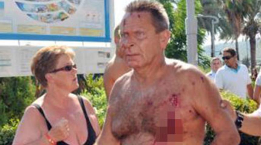 Kemer'de plajda patlama: 10 yaralı