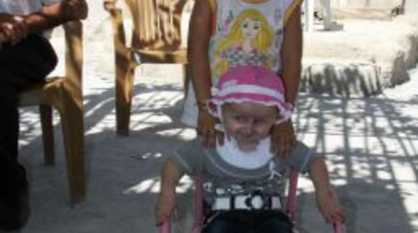 Halerman-Streift hastası Melek, diş ağrılarıyla yaşamaya &ccedil;alışıyor